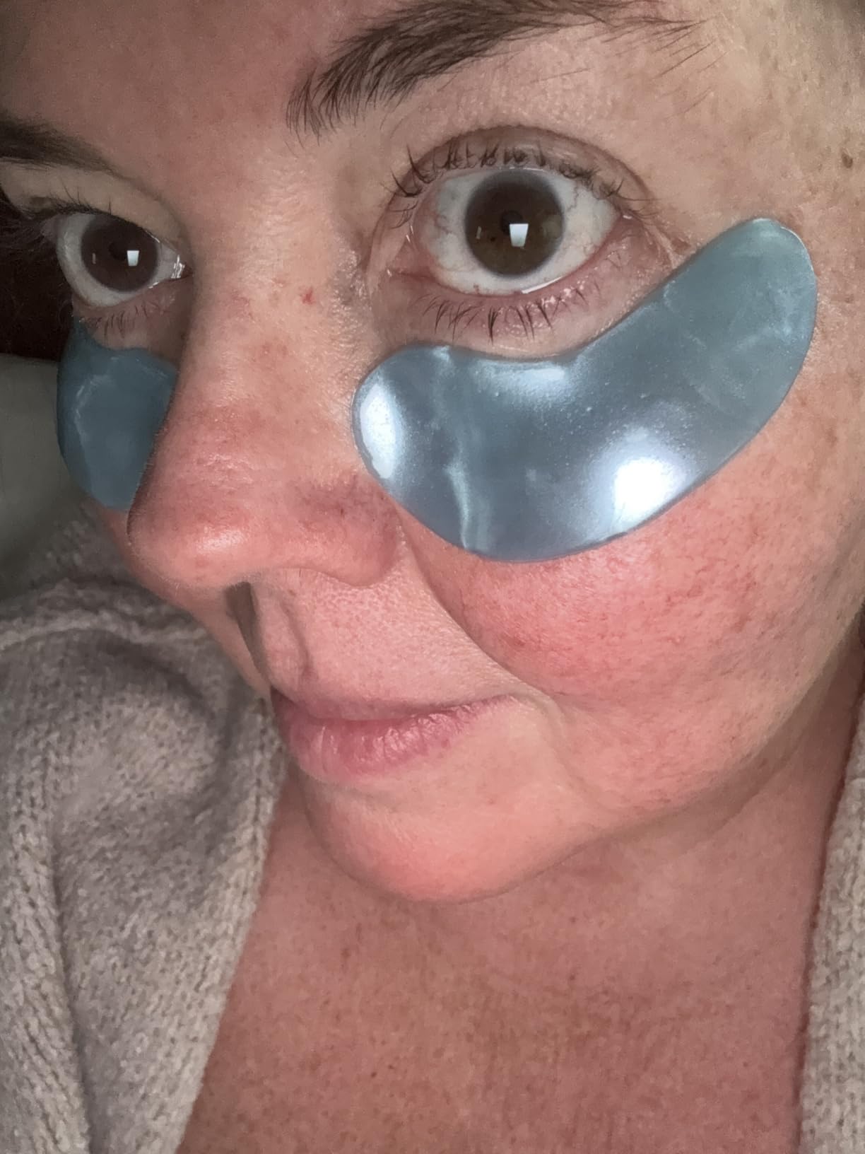 grace & stella Award Winning Eye Patches for Puffy Eyes | Birthday Gifts for Women - Under Eye Mask for Dark Circles & Undereye Bags (24 Pairs, Gold) customer photo 1