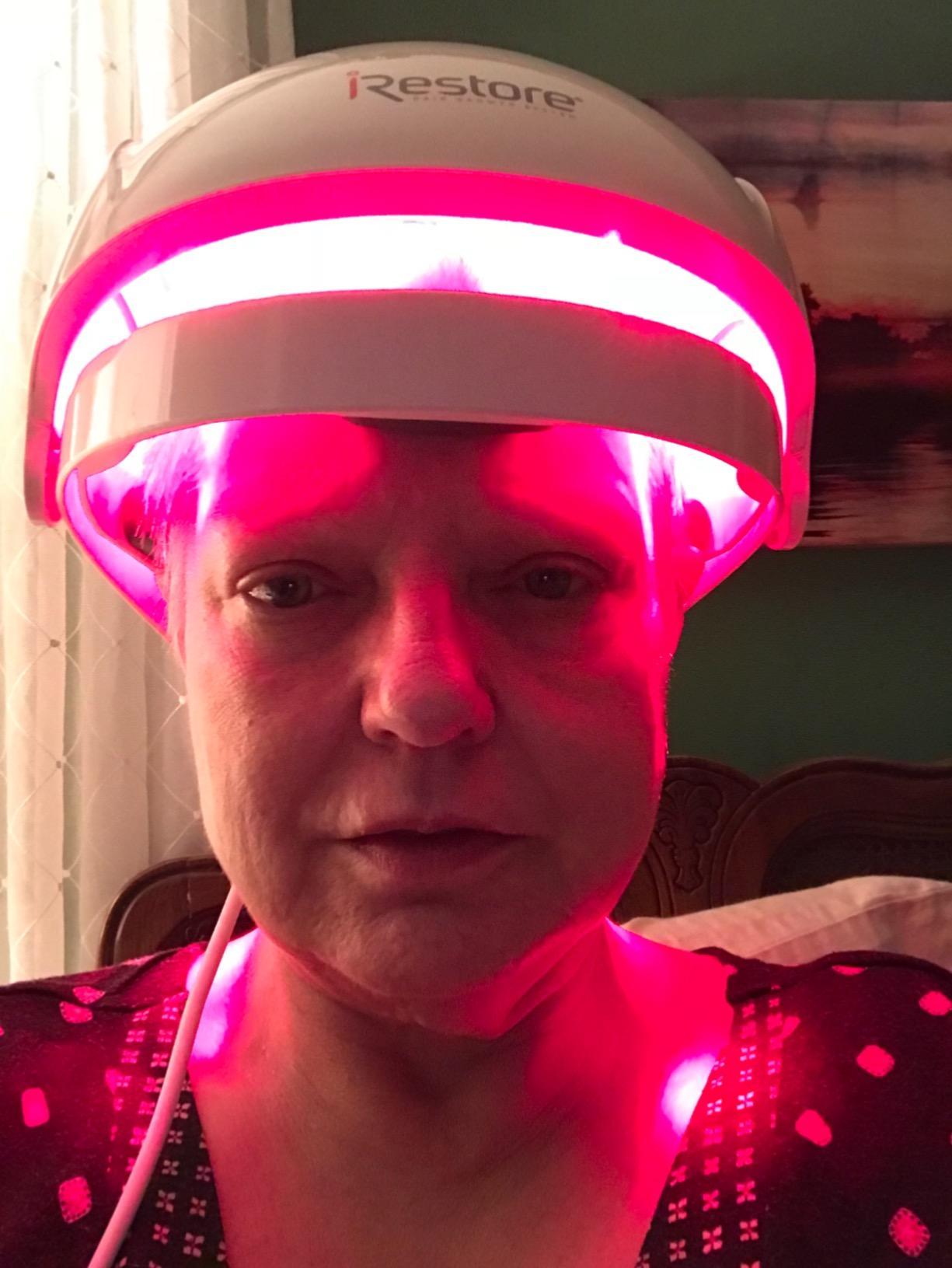 iRestore Essential - Laser Red Light Therapy for Hair Growth - FDA Cleared Hair Loss, Hair Thinning & Alopecia Treatment for Men & Women - Laser Cap for Hair Regrowth Stimulate Denser Fuller Hair customer photo 2