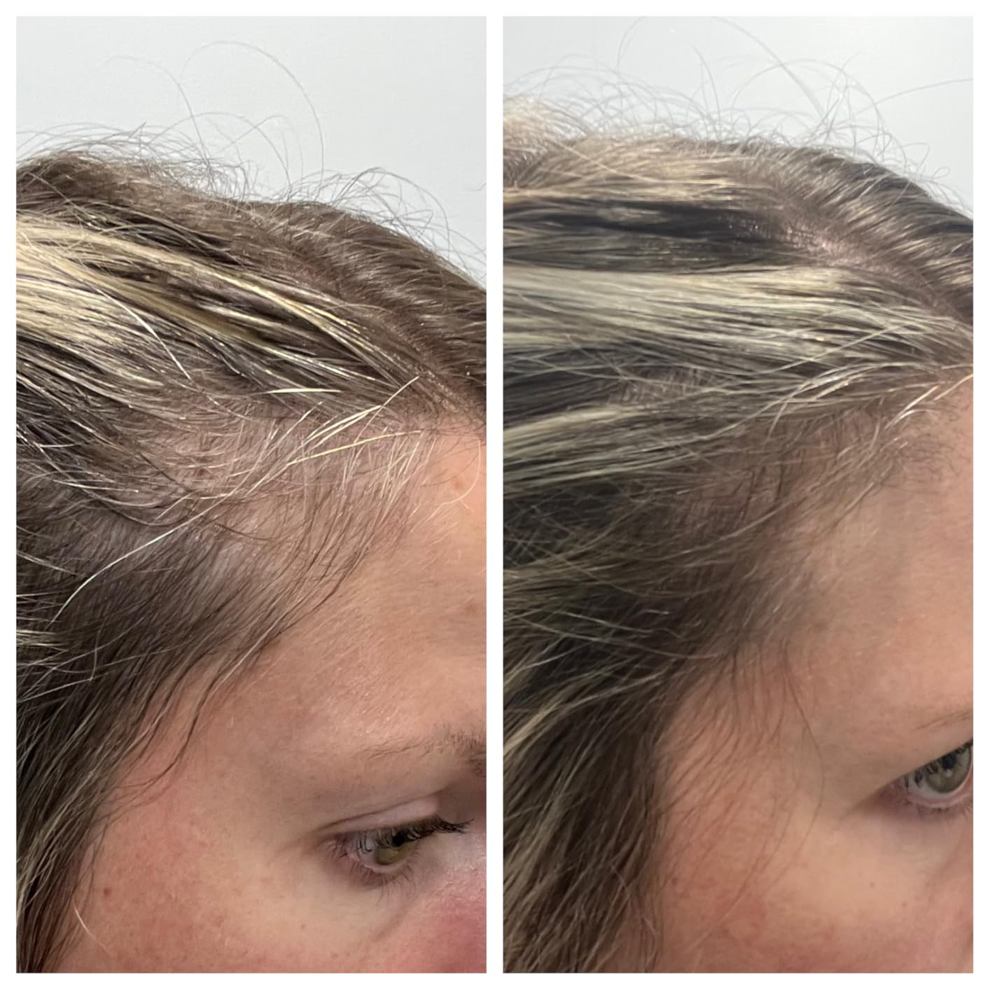 Divi Scalp Serum | To Promote Fuller-Looking Hair with Peptides | Multi-Peptide Complex, Caffeine, Rosemary Oil, Vegan, Non-Greasy customer photo 2