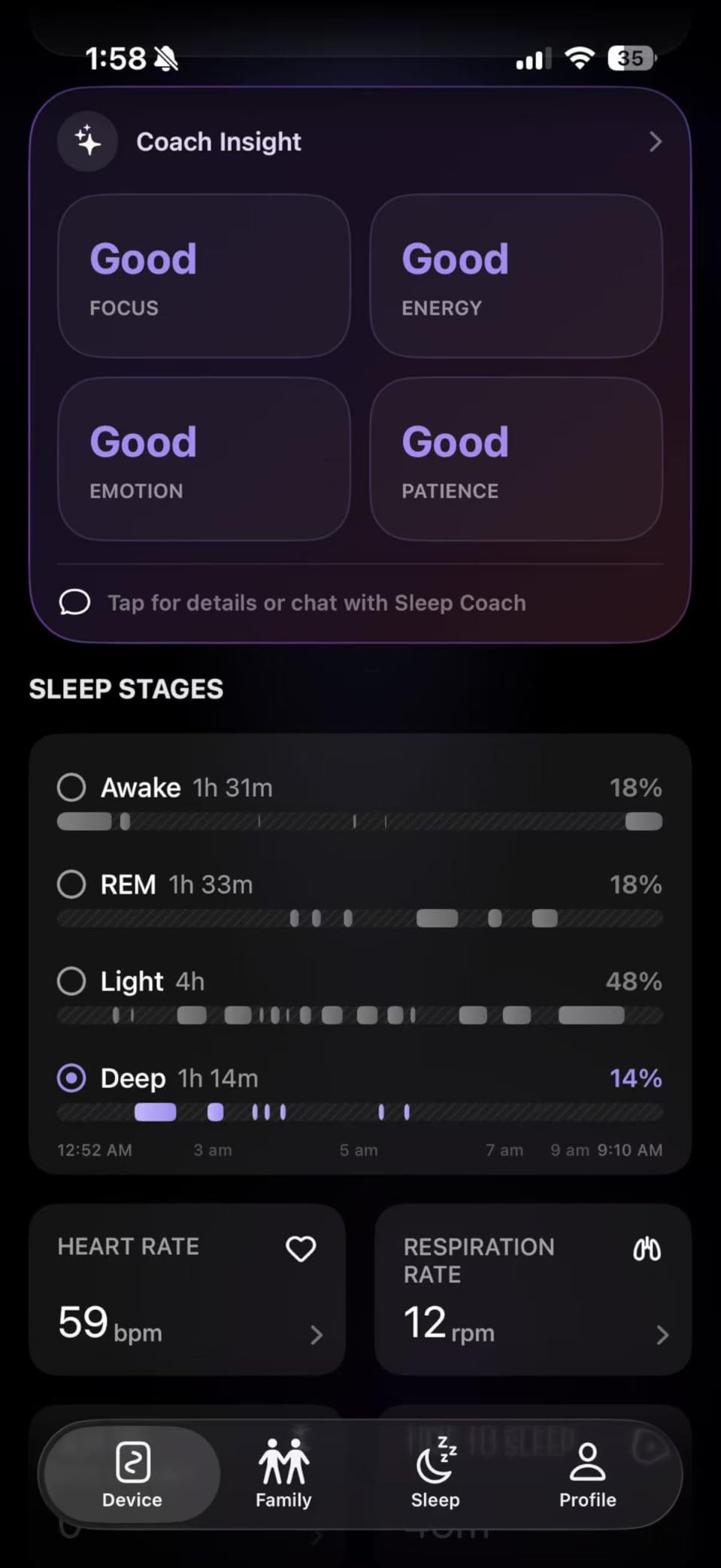 OZI Smart Sleep Tracker, Non-Wearable Contactless Under-Sheet Sleep Monitor | No Monthly Fees customer photo 2