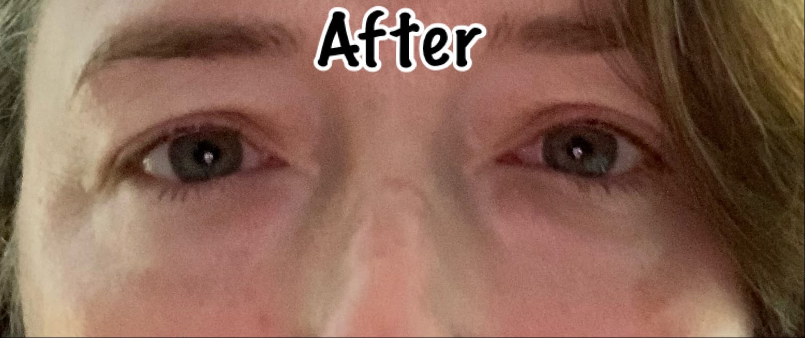 Under Eye Patches (20 Pairs) - Eye Patches For Puffy Eyes And Dark Circles - Under Eye Mask Amino Acid & Collagen For Dark Circles And Puffiness by Celor customer photo 1