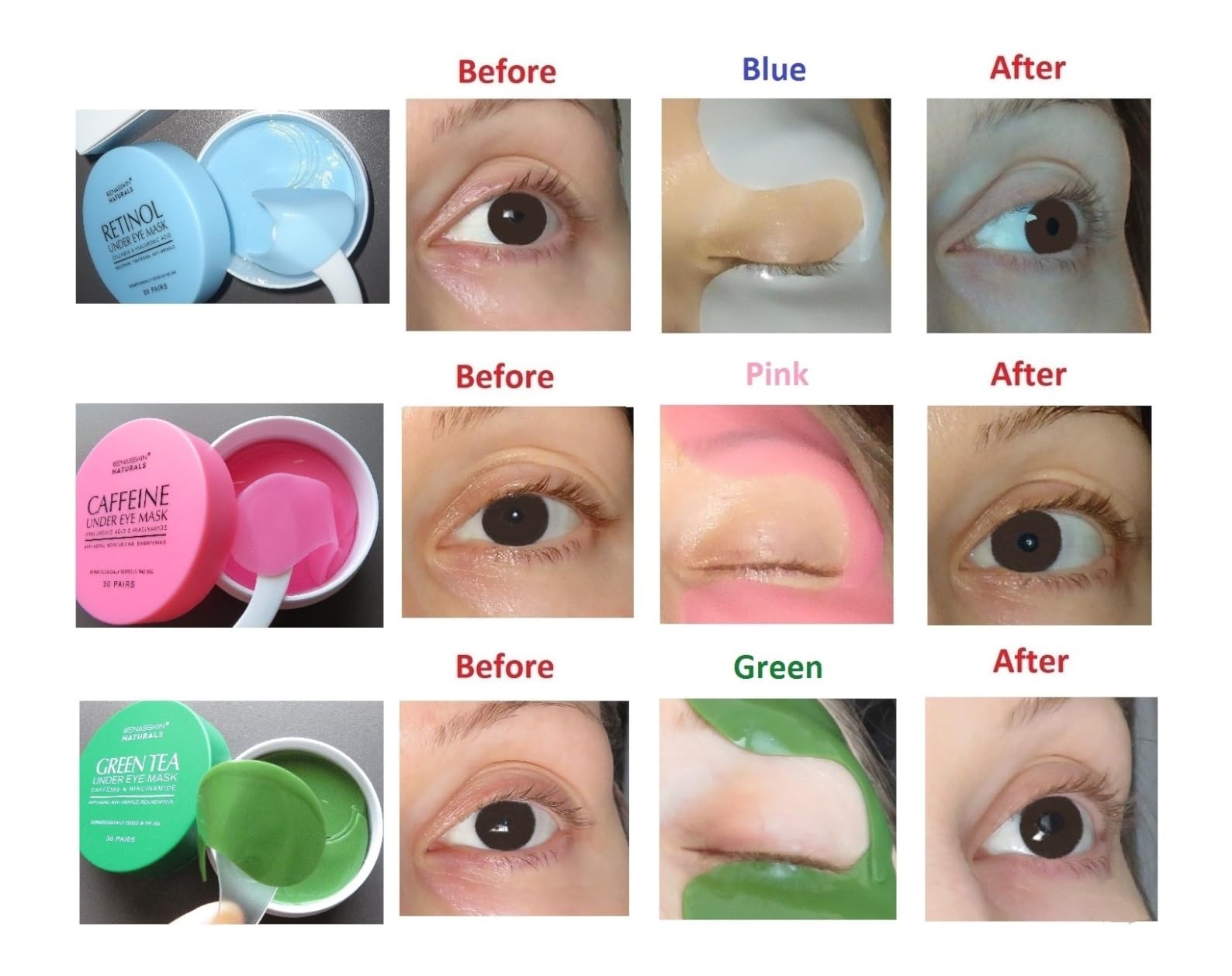 Enaskin Naturals Under Eye Patches for Puffy Eyes & Dark Circles 60 Patches | Retinol and Collagen to Soften Fine Lines and Wrinkles Around the Delicate Eye Area customer photo 1