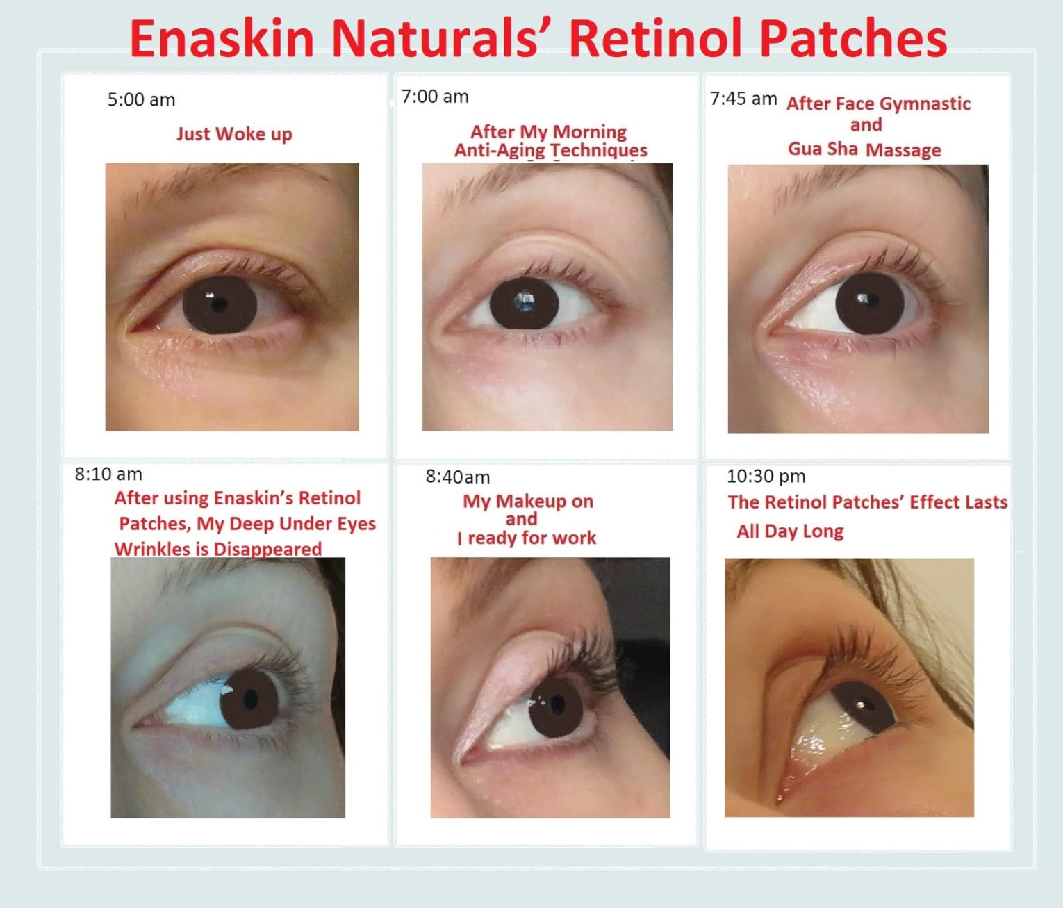 Enaskin Naturals Under Eye Patches for Puffy Eyes & Dark Circles 60 Patches | Retinol and Collagen to Soften Fine Lines and Wrinkles Around the Delicate Eye Area customer photo 2